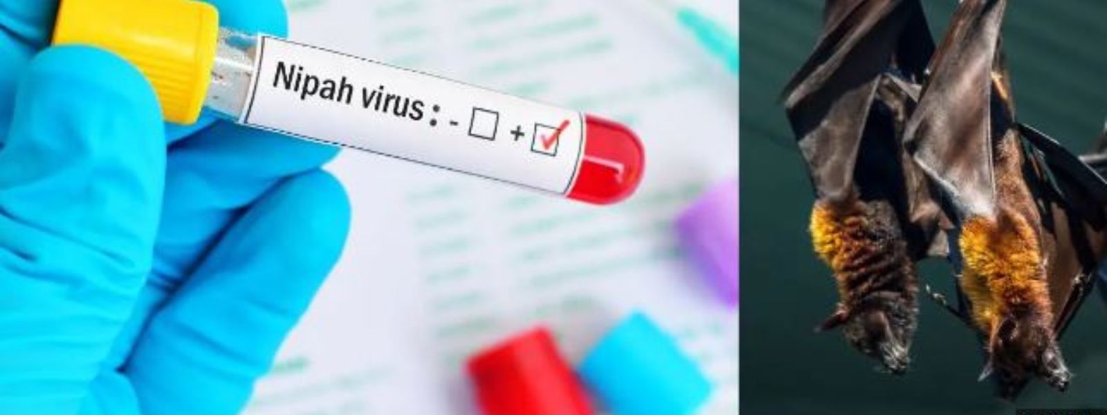 New case of Nipah virus discovered in Kerala